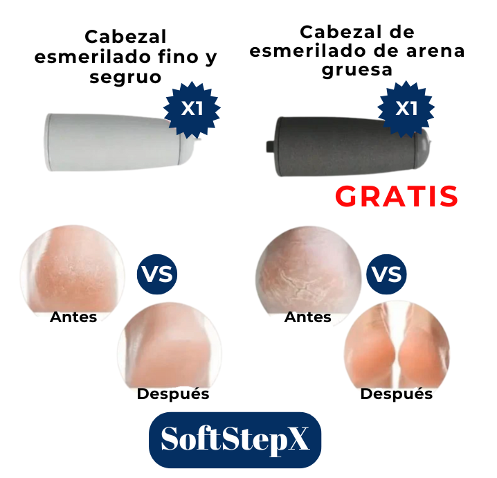 SoftStepX™ - La belleza empieza en tus pies en pocos dias.