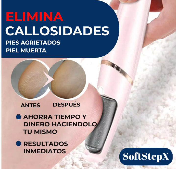 SoftStepX™ - La belleza empieza en tus pies en pocos dias.